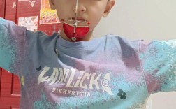 正畸中上颌尖牙向下向后牵引的原理是什么？适用于哪些错颌畸形？临床操作中如何控制牵引方向与效果？