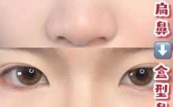 掩饰性正畸能改善鼻子外观吗？