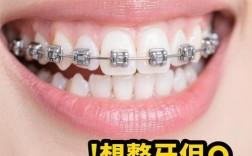 最新牙齿矫正套矫正效果真的比传统方式更好吗？