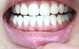 20岁正畸期间牙龈萎缩，是矫正器摩擦还是口腔护理不当导致？会影响牙齿稳固和矫正效果吗？