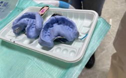 正畸完成后的牙齿模型，该如何处理？