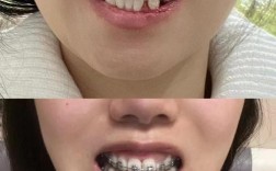 上海牙齿矫正哪家医院好？求推荐！