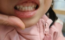 不戴牙套矫正牙齿效果如何？具体方法有哪些？