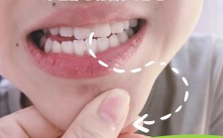 牙齿矫正中咬合不好