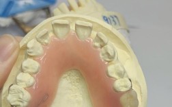 胶托排牙方法的具体操作步骤是怎样的？有哪些关键技巧需要掌握？