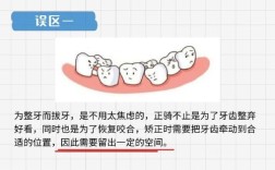 拔智齿会影响正畸吗