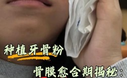 植牙时用了骨粉的反应