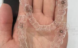 牙齿隐形矫正怎么样？效果、舒适度如何？