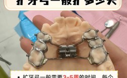 正畸牙弓多久整平