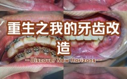 杭州矫正牙齿去哪里？找靠谱机构要注意什么？