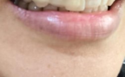 矫正牙齿过程中牙齿真的会松动吗？