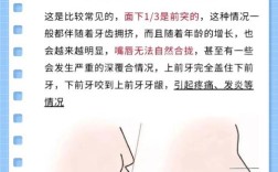 拔6正畸脸型会变吗