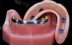 种牙半固定修复与传统修复有何不同？