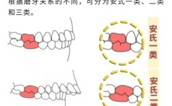 正畸常用方法有哪些？哪项不属于常用方法？