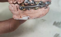 正畸8字形铁丝的作用是什么？矫正原理是怎样的？