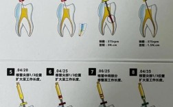 根管治疗怎么治？步骤、效果及注意事项有哪些？