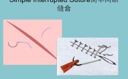 口腔种植缝合方法如何选择更优以减少并发症？