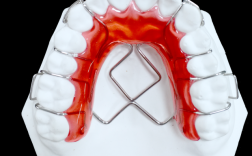 3m牙齿矫正器图片能看清哪些佩戴效果？