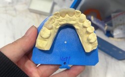 正畸口腔模型灌注寄存如何提升矫正效果？