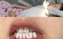 正畸前牙周刮治，为何是矫正成功的关键前提？