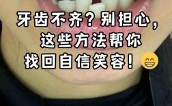 牙不齐有哪些矫正方法？传统牙套、隐形矫正等不同方式的优缺点和适用人群如何选择？