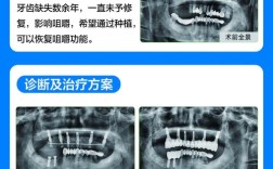 种牙成功的案例