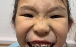 矫正后牙齿形状为何与预期有差异？该如何调整改善？