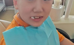 男孩牙齿矫正拔牙