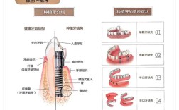 加强后牙支抗有哪几种方法？各自适用什么情况？