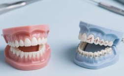 正畸咬合平面倾斜