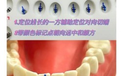 正畸颊面管左右对应牙位