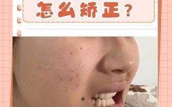 正畸过程中下牙内倾是什么原因导致的？会对咬合功能和面部美观产生哪些影响？