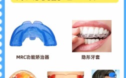 地包天牙齿怎样矫正