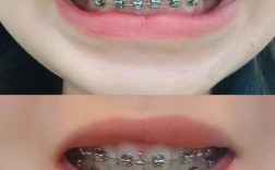 合肥哪家矫正牙齿好