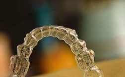 隐形牙齿矫正器团购，低价真的靠谱吗？质量与效果有保障吗？