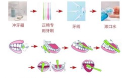 矫正期间如何清洁牙齿