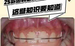25岁矫正牙齿吗