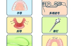 摇椅弓打开咬合的方法是什么？技术要点与临床应用