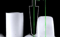 前牙预备方法视频教程中，如何根据不同牙位（中切牙/侧切牙/尖牙）调整预备形态？边缘肩台的位置与宽度如何精准把控？