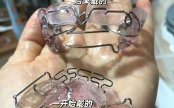 成年地包天矫正方法有哪些？不同矫正方式的优缺点是什么？矫正周期和效果会因人而异吗？