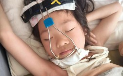 牙齿矫正牵引疼