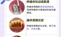 套牙种牙的寿命