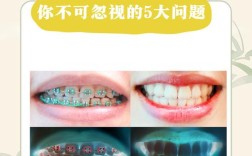 牙齿松动还能做矫正吗