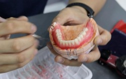 全口义齿装盒方法优点