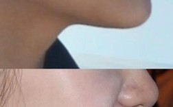 正畸后牙齿整齐了，怎么还是有点龅牙？