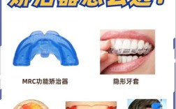 地包天牙齿矫正哪里好？靠谱机构怎么选？