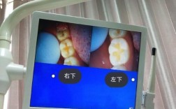 拜博口腔蛀牙怎么治？有哪些注意事项和费用？