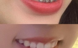 正畸侧面拍照为何需标准图片？效果对比关键依据在此？