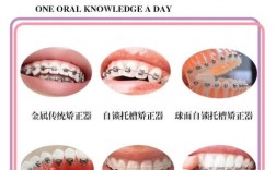 口腔正畸支抗分类