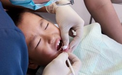 乳牙拔除的方法